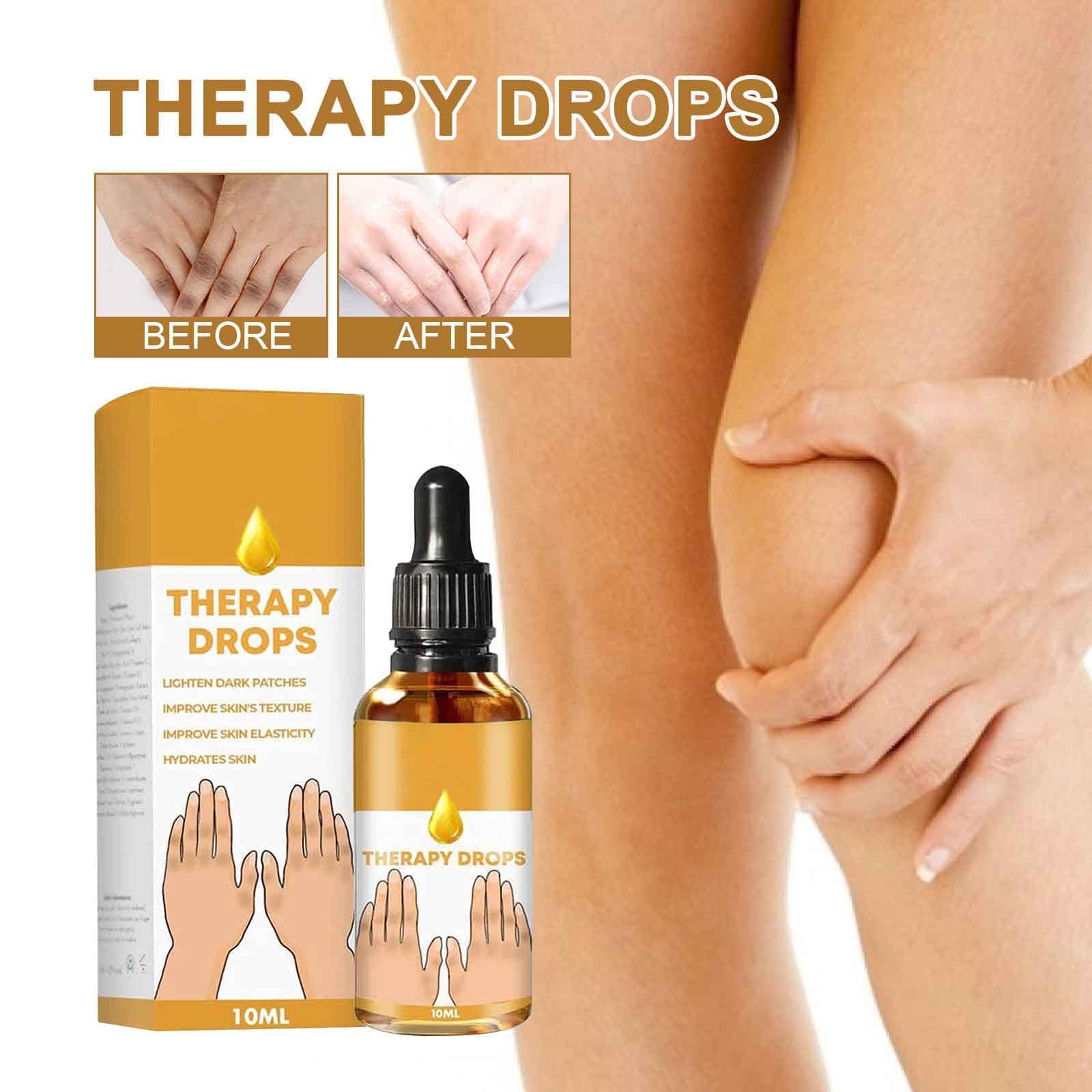 3Pcs Acanthosis Nigricans Therapy Oil - 10ml Nigricare Dark Spot Treatment Drops for Face, Elbows & Knees | Skin Brightening Serum for Hyperpigmentation | Perfect for Nighttime Skincare & Body Care Routine