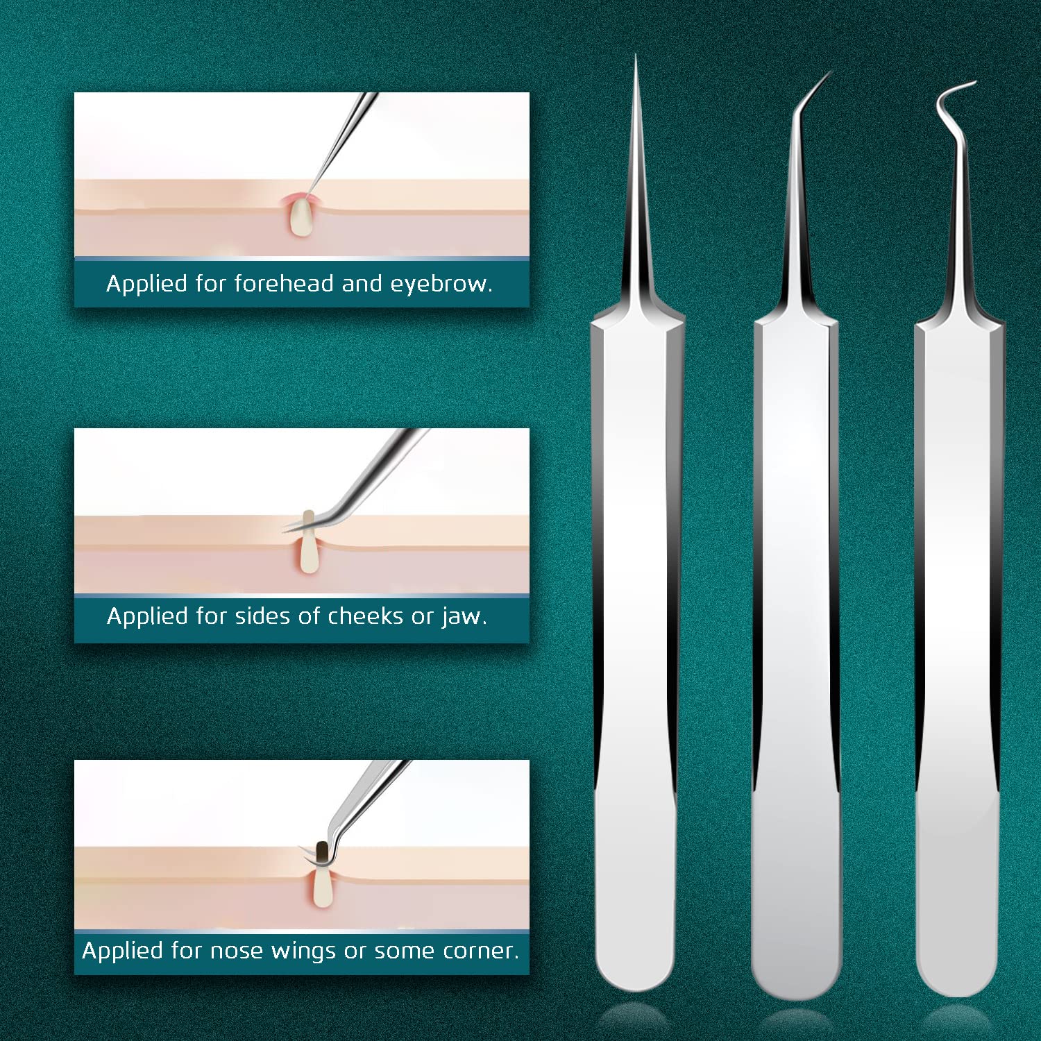 Professional Blackhead & Pimple Remover Tool Kit - Acne Comedone Extractor for Nose & Face Skin Care - Comes with Travel Case - Perfect for Home Spa & Dermatologist-Recommended Skin Treatment