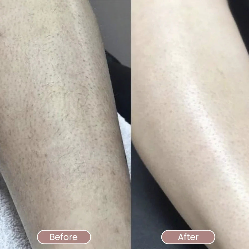 Crystal Hair Remover Roller - Painless Hair Removal for Face & Body | Smooth Skin at Home | Perfect for Bikini Line, Arms, Legs & Underarms