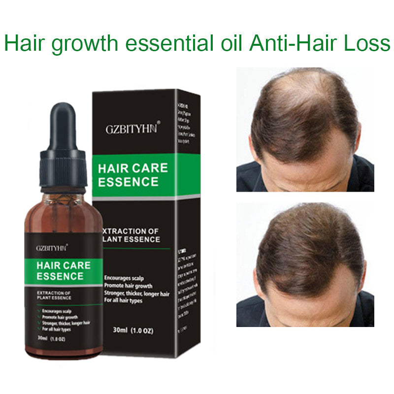 Premium Hair Growth Oil for Thicker & Longer Hair - Natural Essential Oil Treatment for Hair Care & Scalp Health - Perfect for Daily Use, Styling & Hair Loss Prevention