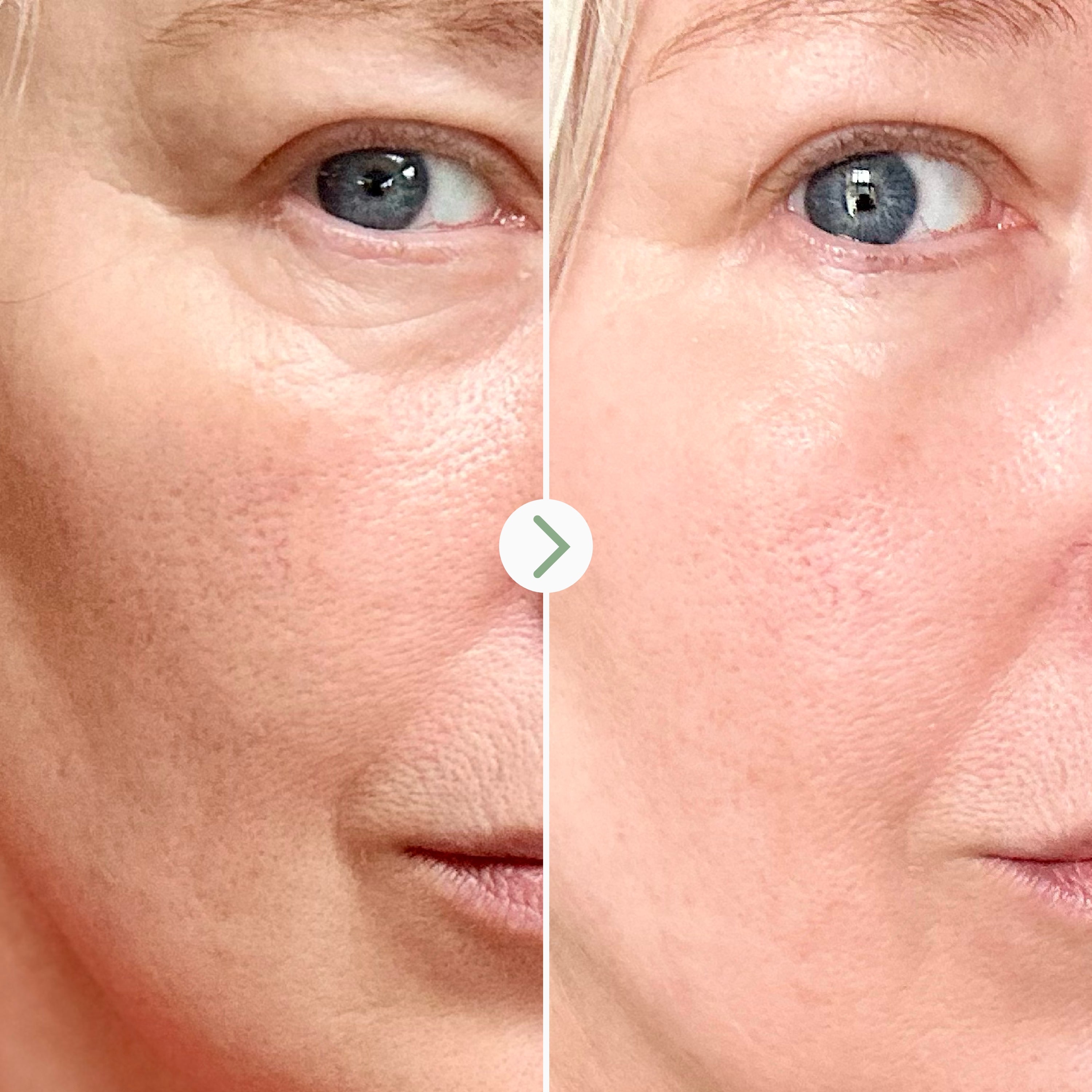 Bonne Nuit Renewal Night Cream - Anti-Aging Moisturizer for Overnight Skin Repair | Best for Dry & Sensitive Skin | Perfect Nighttime Skincare Routine