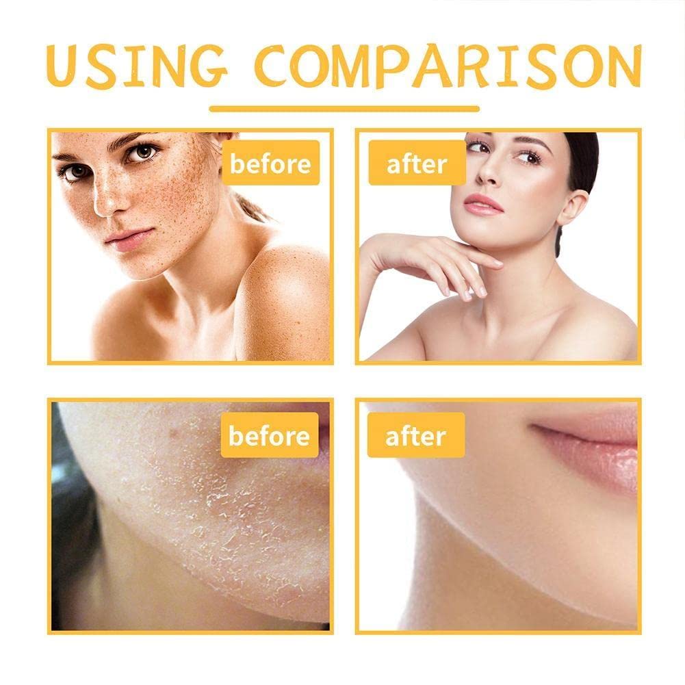 100g Turmeric Body Scrub - Exfoliating & Brightening Skin Treatment for Dark Spots & Melanin - Moisturizing & Skin Clearing Formula - Wholesale Bulk - Perfect for Spa, Home Skincare & Gift Sets