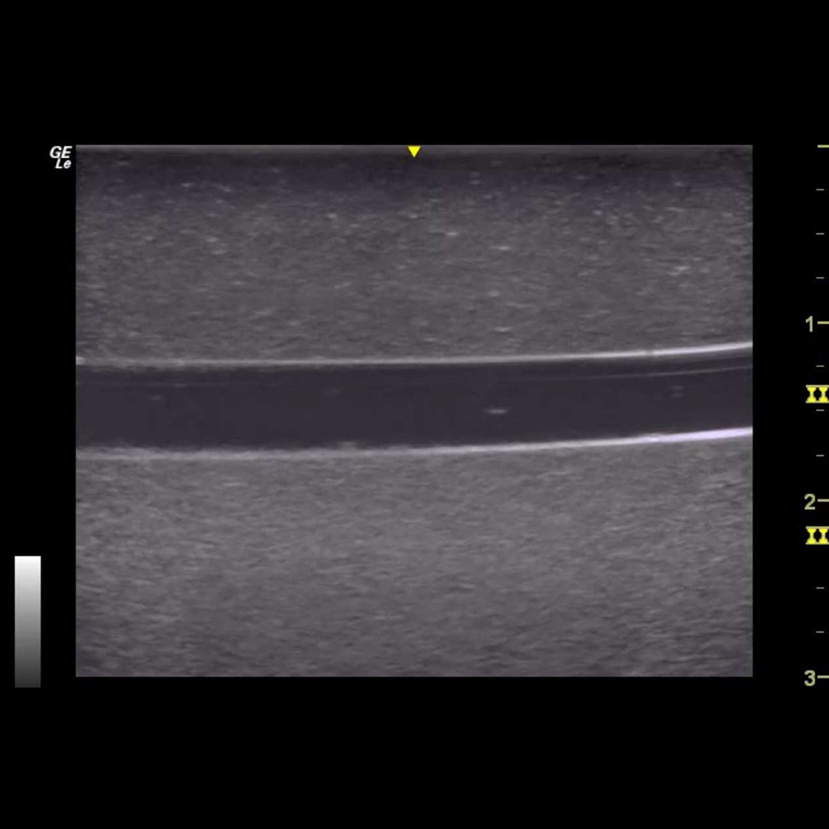 HM2.0 Remoldable 2-Vessel Ultrasound Training Model - Perfect for Medical Students & Sonography Practice (Arterial & Venous Vessel Simulation)