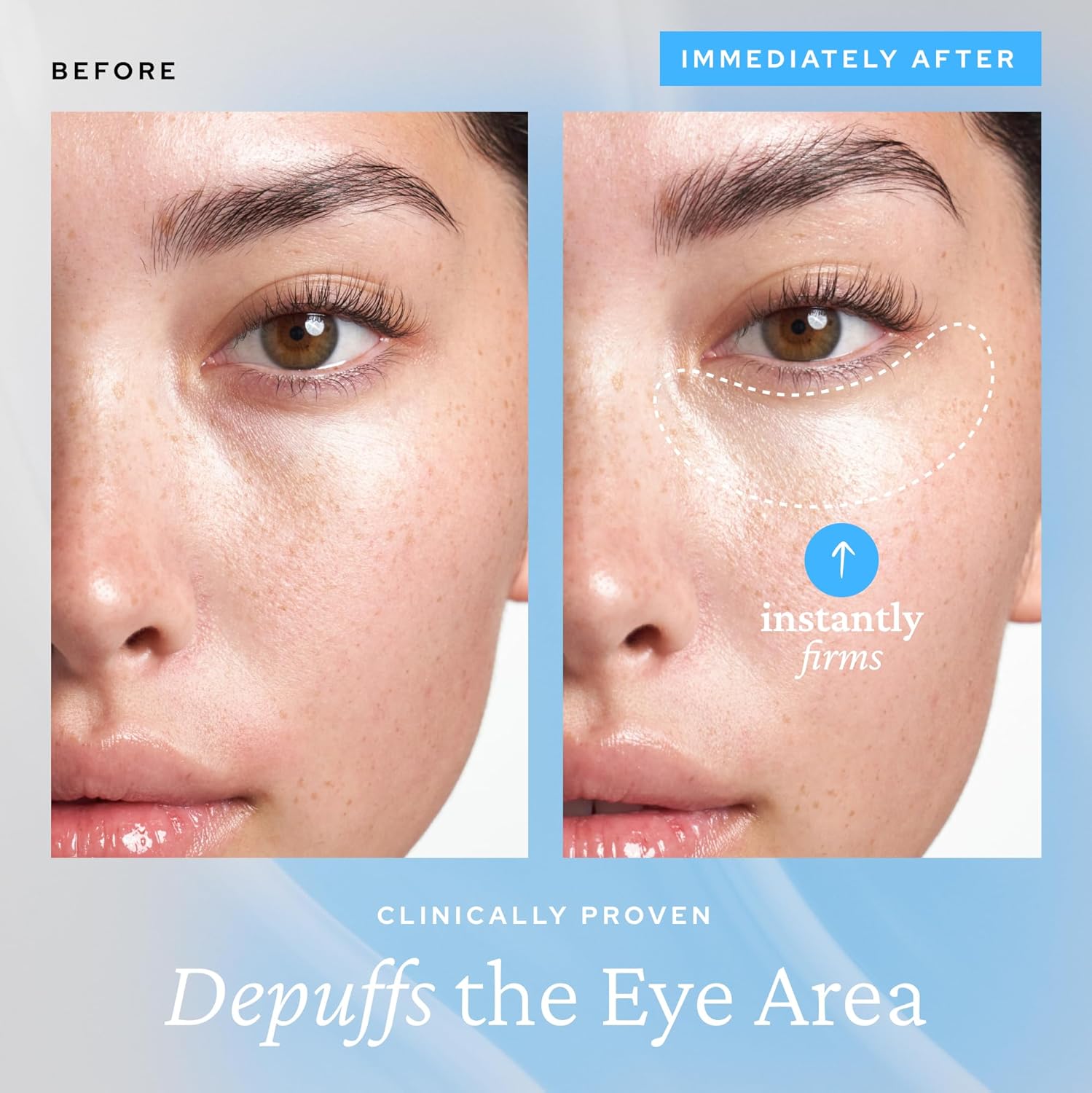 Belif Aqua Bomb Hydrating Eye Gel 15ml - Soothing Under Eye Treatment for Dark Circles & Puffiness - Perfect for Travel & Daily Skincare Routine