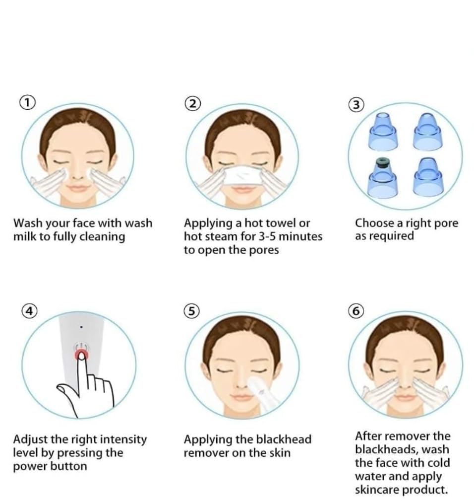 Blackhead Remover Vacuum Kit - 4-in-1 Multi-Function Pore Cleaner for Acne & Pimple Removal, Skin Care Tool for Beautiful Complexion (White) | Perfect for Daily Facial Cleansing & Spa Treatments