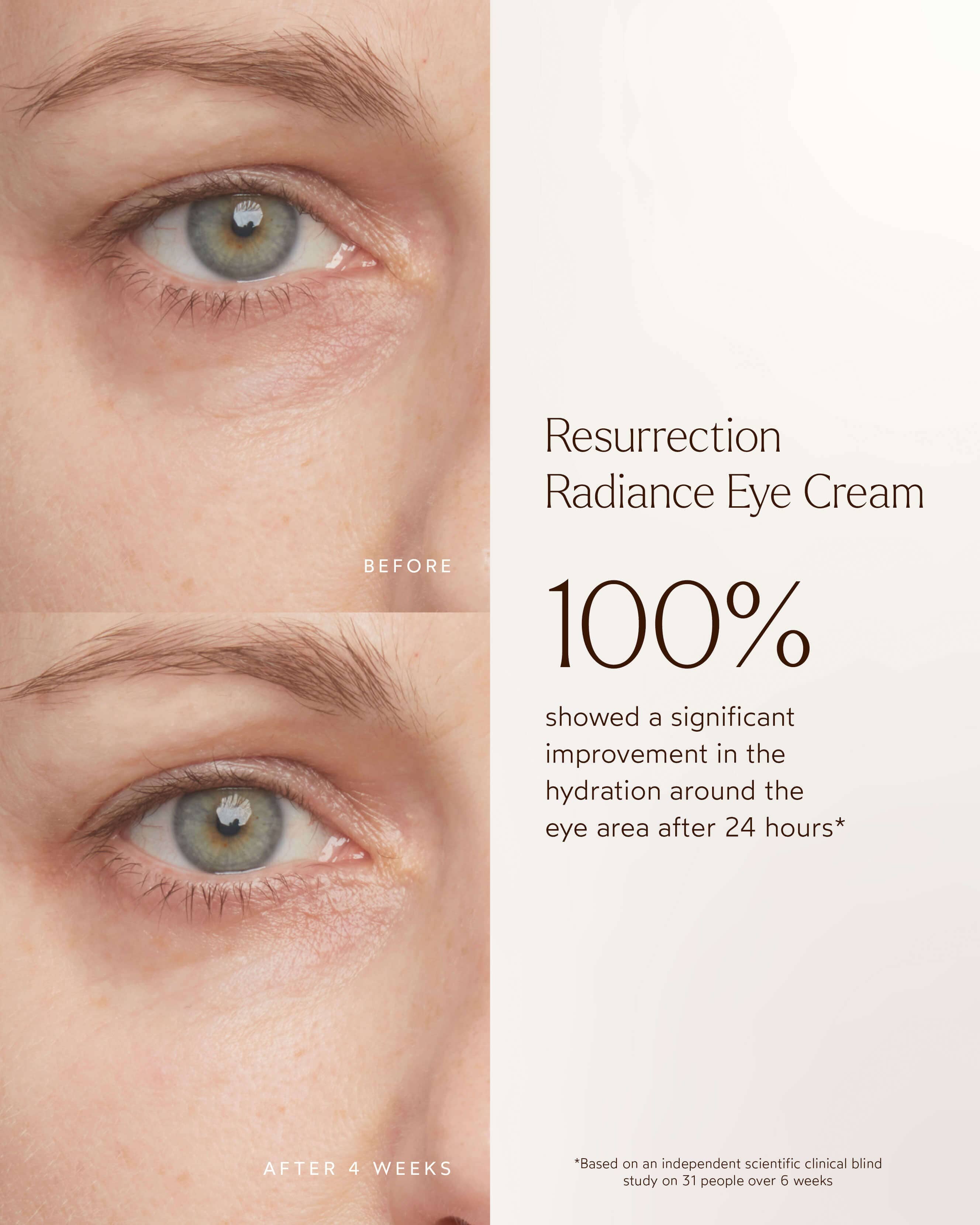 Resurrection Radiance Anti-Aging Eye Cream for Dark Circles & Wrinkles - Hydrating Under Eye Treatment for Puffiness & Fine Lines - Perfect for Nighttime Skincare Routine & Daily Use
