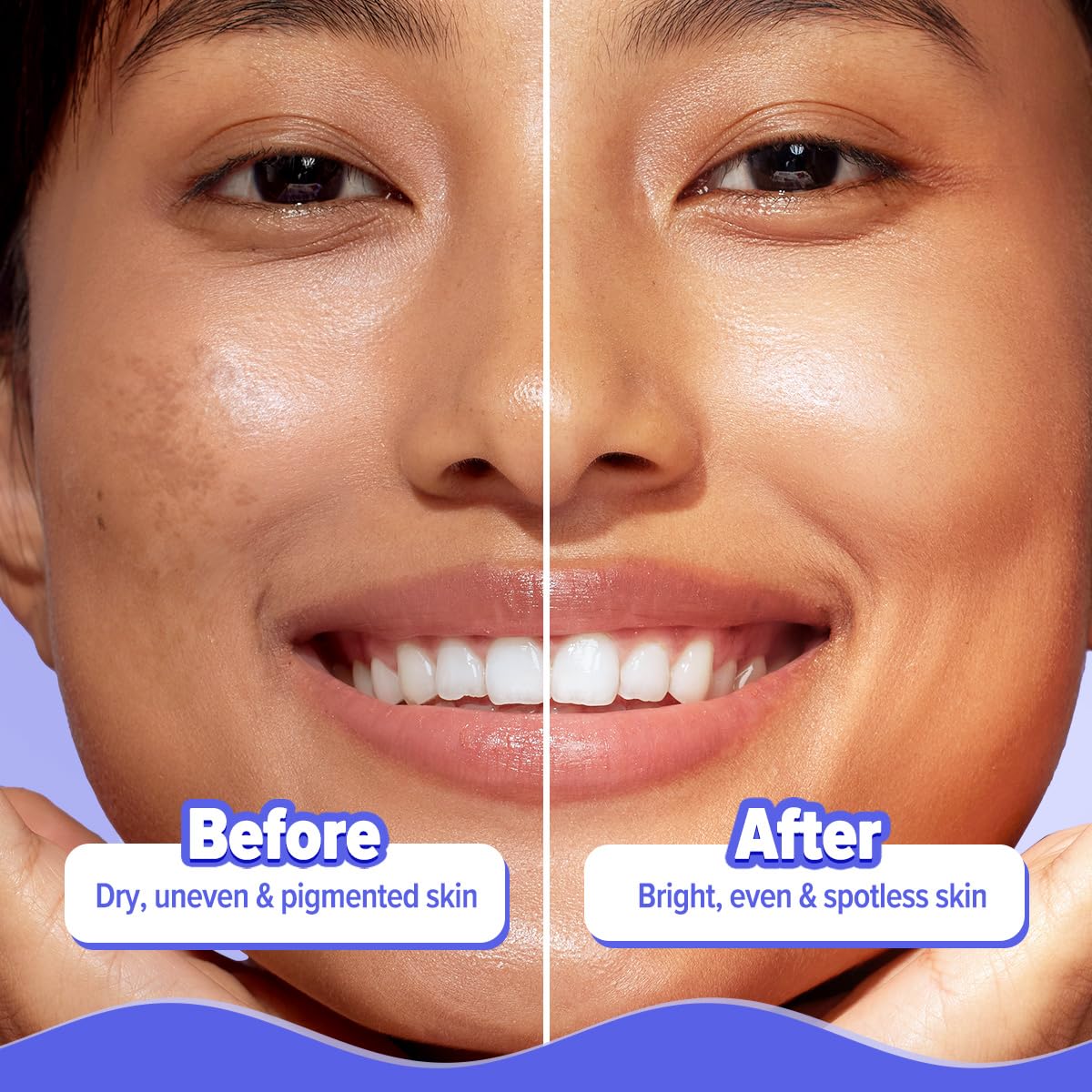 Aqualogica Illuminate+ 20x Alpha Arbutin Brightening Serum 50ml - Dark Spot Corrector for Hyperpigmentation & Uneven Skin Tone | Hydrating & Plumping Face Treatment | Perfect for Daily Skincare Routine & Nighttime Use