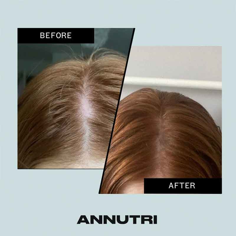Annutri Grow It Hair Growth Supplement - 1 Month Supply for Thicker, Stronger Hair - Perfect for Men & Women with Thinning Hair or Hair Loss