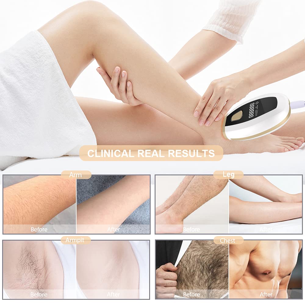 IPL Hair Removal Device for Women - Permanent Painless Hair Remover for Face, Arms, Legs, Bikini Line & Underarms | At-Home Laser Hair Removal System for Smooth Skin | Perfect for Salon-Quality Results at Home