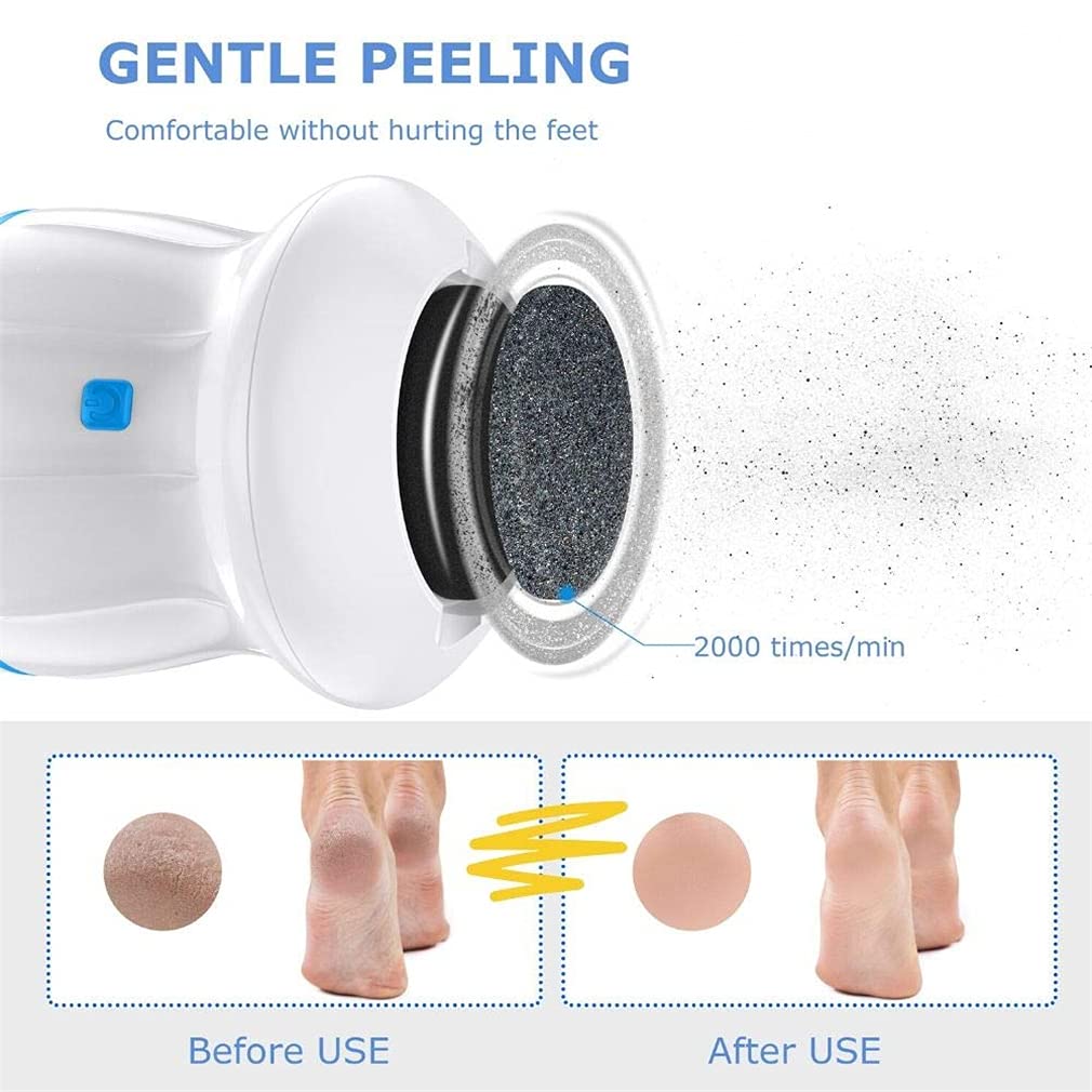 Electric Foot Callus Remover & Pedicure Tool - Portable Rechargeable Foot Grinder with Vacuum Adsorption for Dead, Hard, Cracked & Dry Skin - Heel Repair & Foot Care for Smooth Soft Feet - Perfect for Home Spa, Travel & DIY Pedicure (Blue)