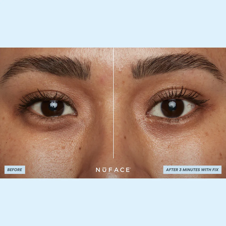 NuFACE IonPlex Hydra Gel Power Patches - Hydrating Facial Treatment for Glowing Skin | Reduce Wrinkles & Fine Lines | Perfect for Night Routine & Pre-Makeup Prep