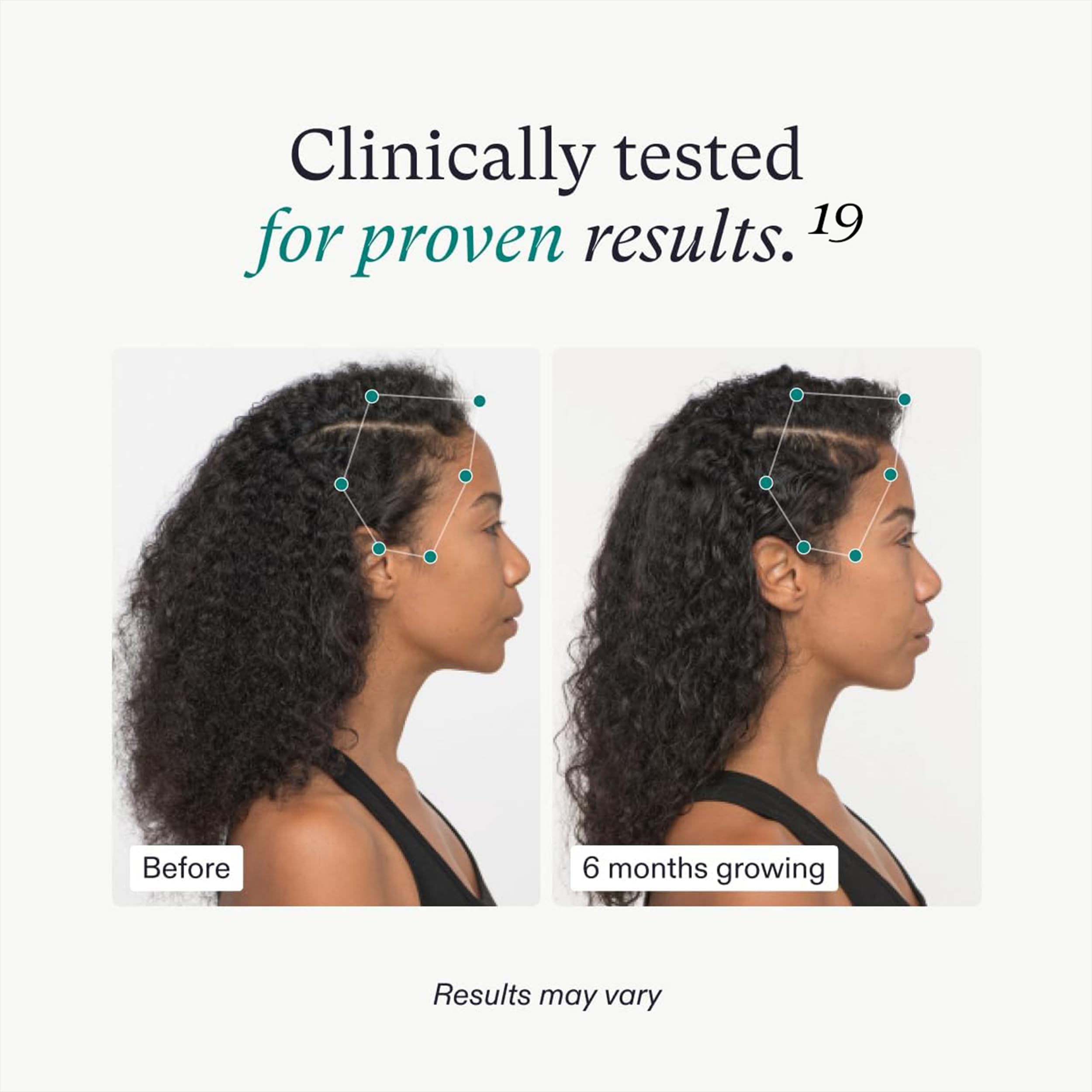 Nutrafol Women's Hair Growth Supplements for Thicker, Stronger Hair - Clinically Tested, 100% Vegan, Dermatologist Recommended (2 Month Supply) - Ideal for Women 18-44 Years Old to Boost Hair Health at Home & Work
