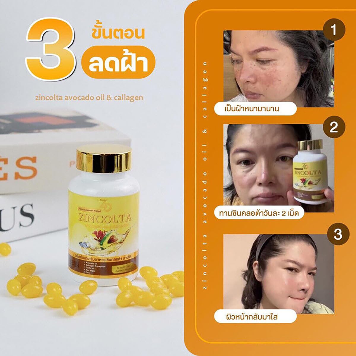 Natural Moisture Nourish Smooth Skin 30 Capsules/Bottle - Zincolta Avocado Oil & Collagen Supplement (Pack of 4) by Thaigiftshop | Hydrating Skin Care for Dry Skin & Anti-Aging | Free Tomato Facial Mask Included