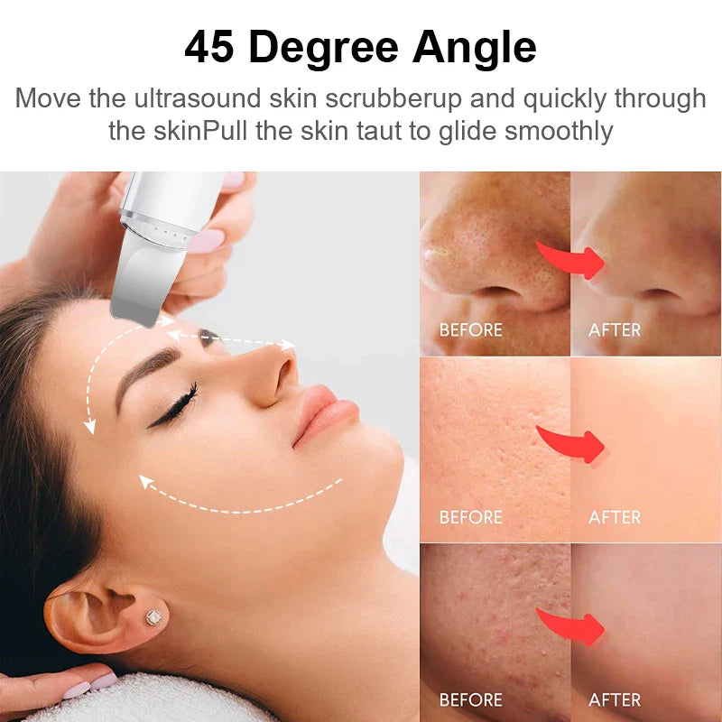 Professional Skin Scrubber Face Spatula - Blackhead & Pore Cleaner Tool for Deep Cleansing - Perfect for Facial Care & Spa Treatments at Home