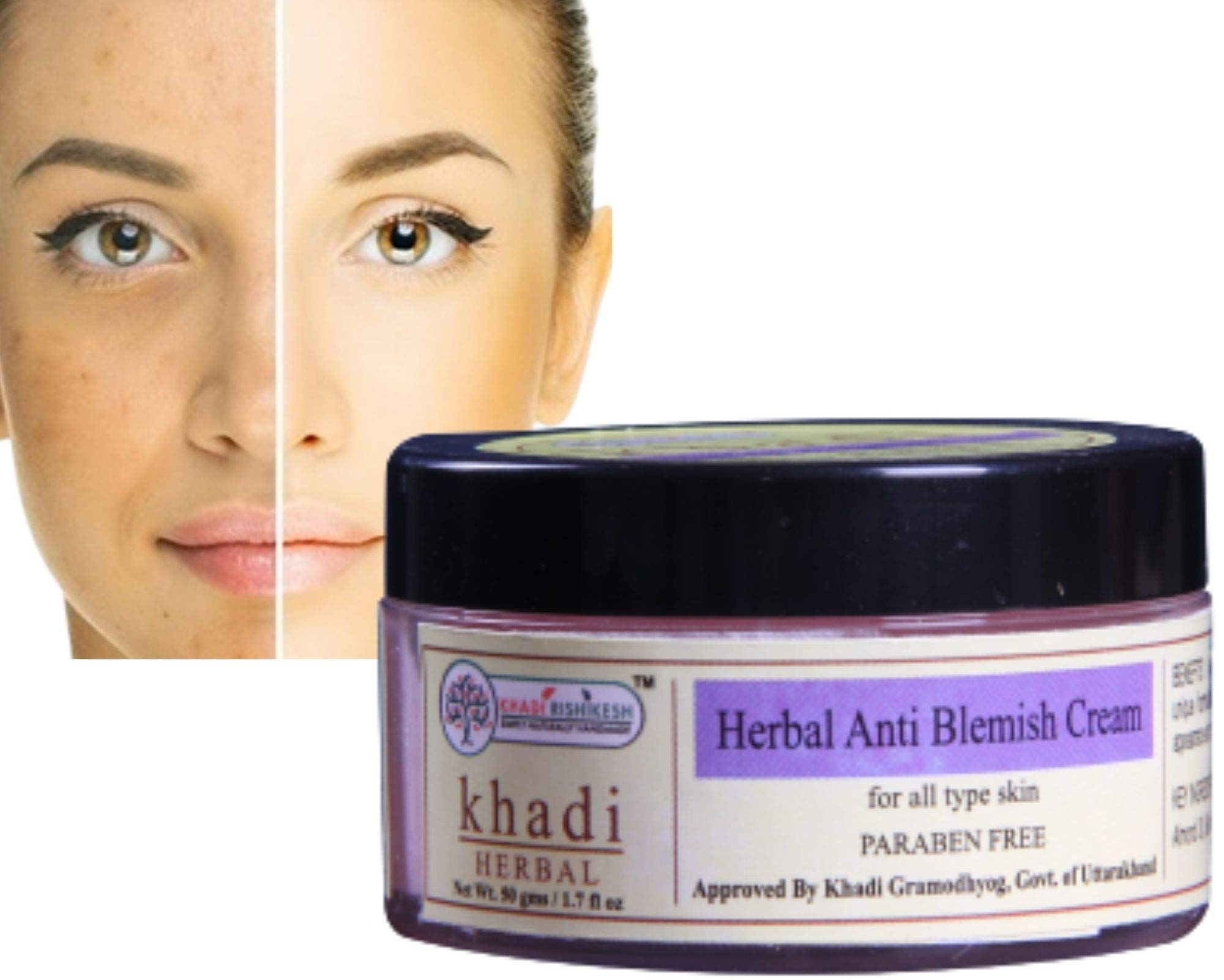 Khadi Rishikesh Herbal Anti Blemish Cream - Reduces Dark Spots & Brightens Skin for Women & Men | Paraben-Free, 50gm | Perfect for Daily Skincare Routine & Acne-Prone Skin