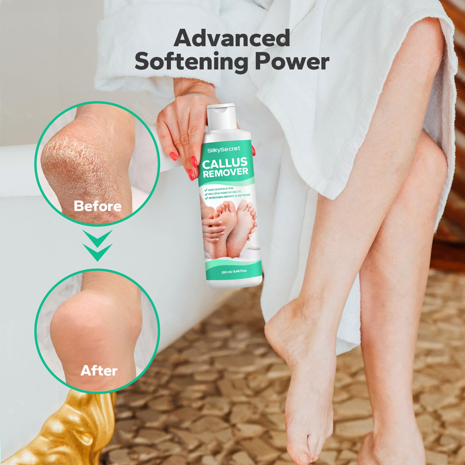 Professional Callus Remover Gel for Feet - Extra Strength 8.45 fl.oz Foot Care Treatment | Cracked Heel & Hard Skin Remover | At-Home Pedicure Solution for Soft Smooth Feet - Perfect for Dry Feet, Calluses & Rough Skin Care Routine