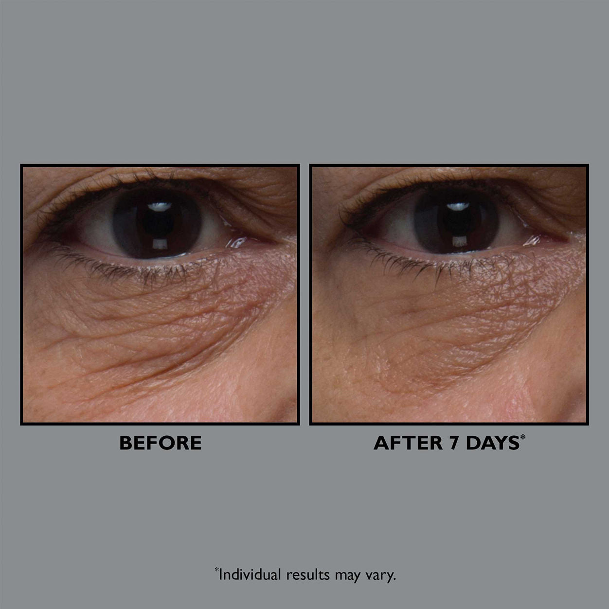 FirmX Anti-Aging Collagen Eye Cream for Dark Circles & Wrinkles - Hydrating Under Eye Treatment for Puffiness & Fine Lines - Perfect for Night & Day Use