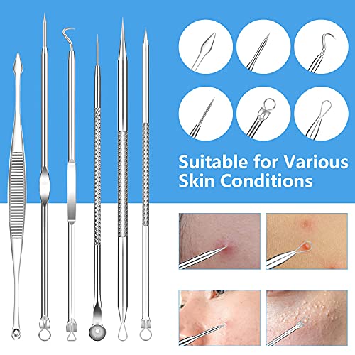 2024 Professional Blackhead Remover Kit - 20PCS Stainless Steel Comedone Extractor Tools for Acne, Pimples & Whitehead Removal - Dermatologist-Recommended Blackhead Extractor Set for Face & Body Care - Perfect for Home Spa & Skincare Routine