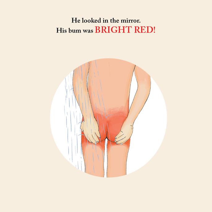 Willy and His Sunburnt Bum - Funny Kids Adventure Book for Summer Reading & Beach Trips