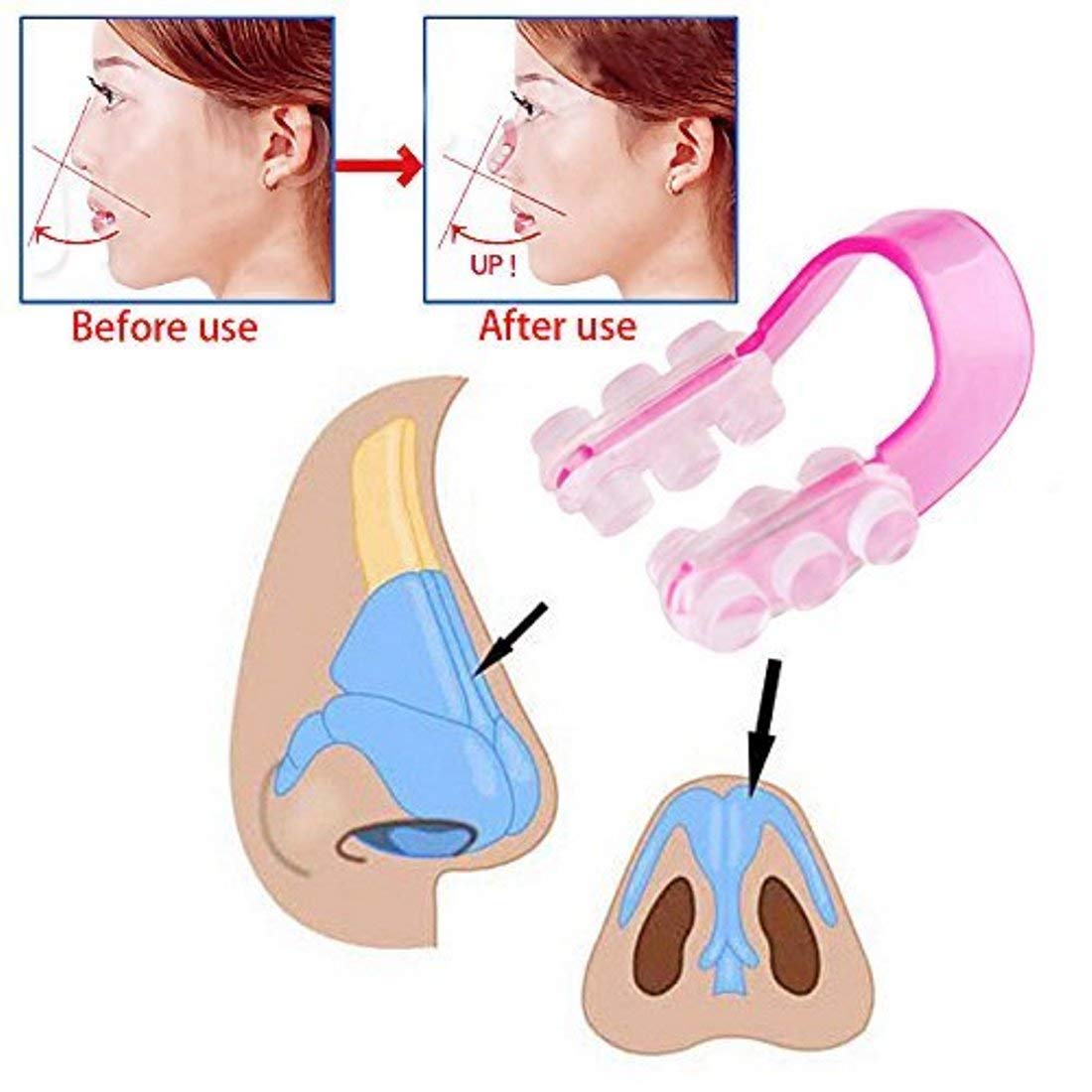 AlexVyan Pink & Purple Nose Up Clip - Nose Shaping & Lifting Tool for Bridge Straightening, Beauty Correction & Enhancement | Perfect for Daily Makeup Routine & Cosmetic Procedures