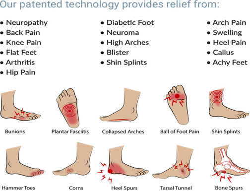 Superthotics - Premium Orthotic Insoles for Foot Pain Relief & Arch Support - Ideal for Running, Walking & Standing All Day