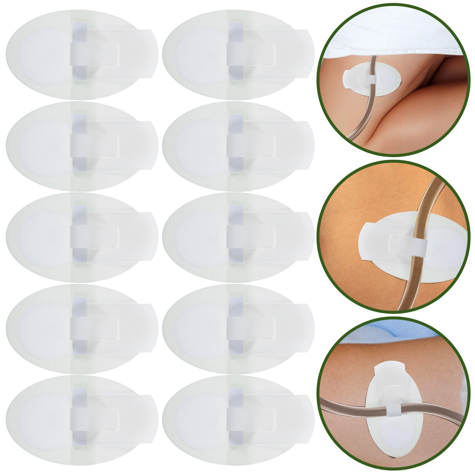 10pcs Catheter Leg Band Holder - Secure & Comfortable Urinary Tube Drainage Bag Fixing Sticker | Medical Supplies for Post-Surgery, Home Care & Hospital Use