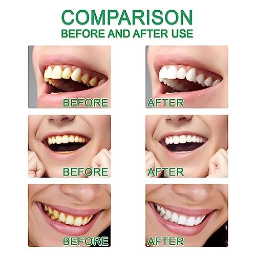 Natural Teeth Whitening Powder for Coffee, Tea & Smoking Stains | Sensitivity-Free Brightening Formula | Peroxide-Free & Mint Flavored (5 Pack) – Perfect for Daily Use at Home, Travel & Gifting
