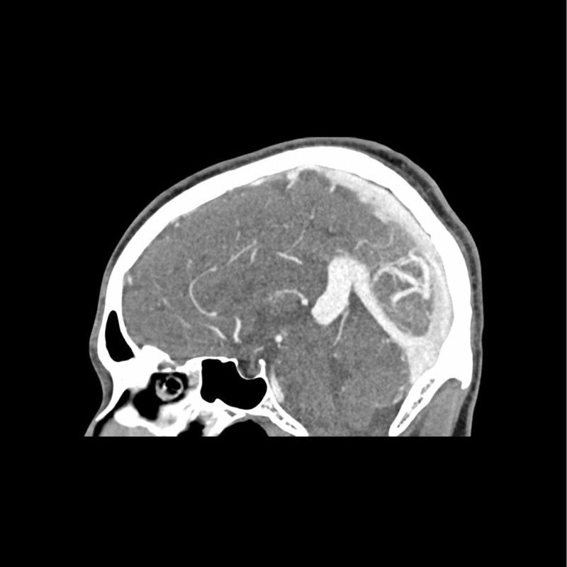 CTA AVM / Lesion Head Phantom - High-Quality CT Scan & X-Ray Training Tool for Medical Students & Radiology Professionals | Perfect for Diagnostic Imaging Practice & Medical Education