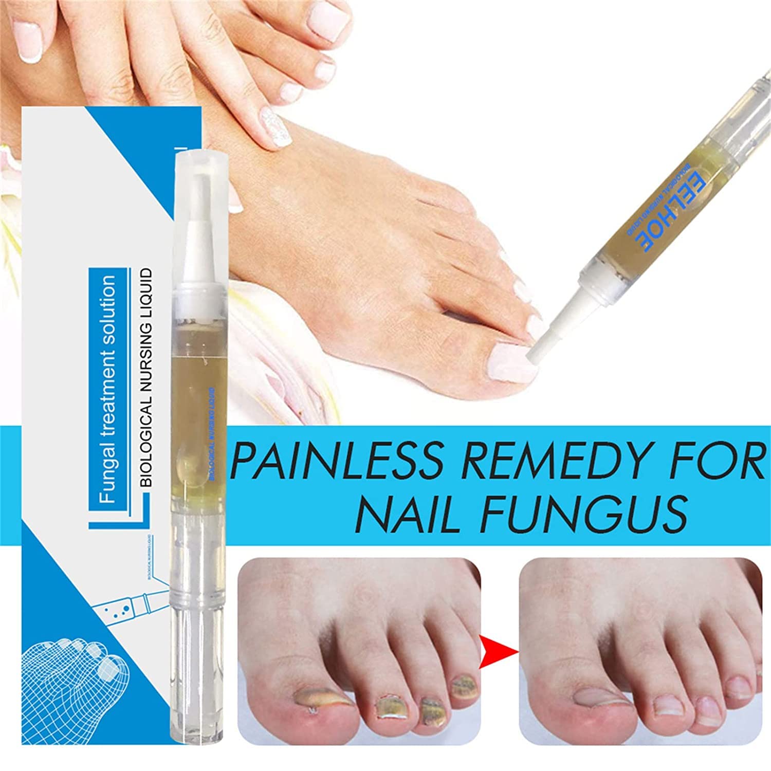 Okita Toenail Fungus Treatment Pen - Fast-Acting Antifungal Nail Repair for Toenails & Fingernails - Clinically Proven Fungus Eliminator (3 Pack) - Perfect for Athletes, Swimmers & Daily Foot Care
