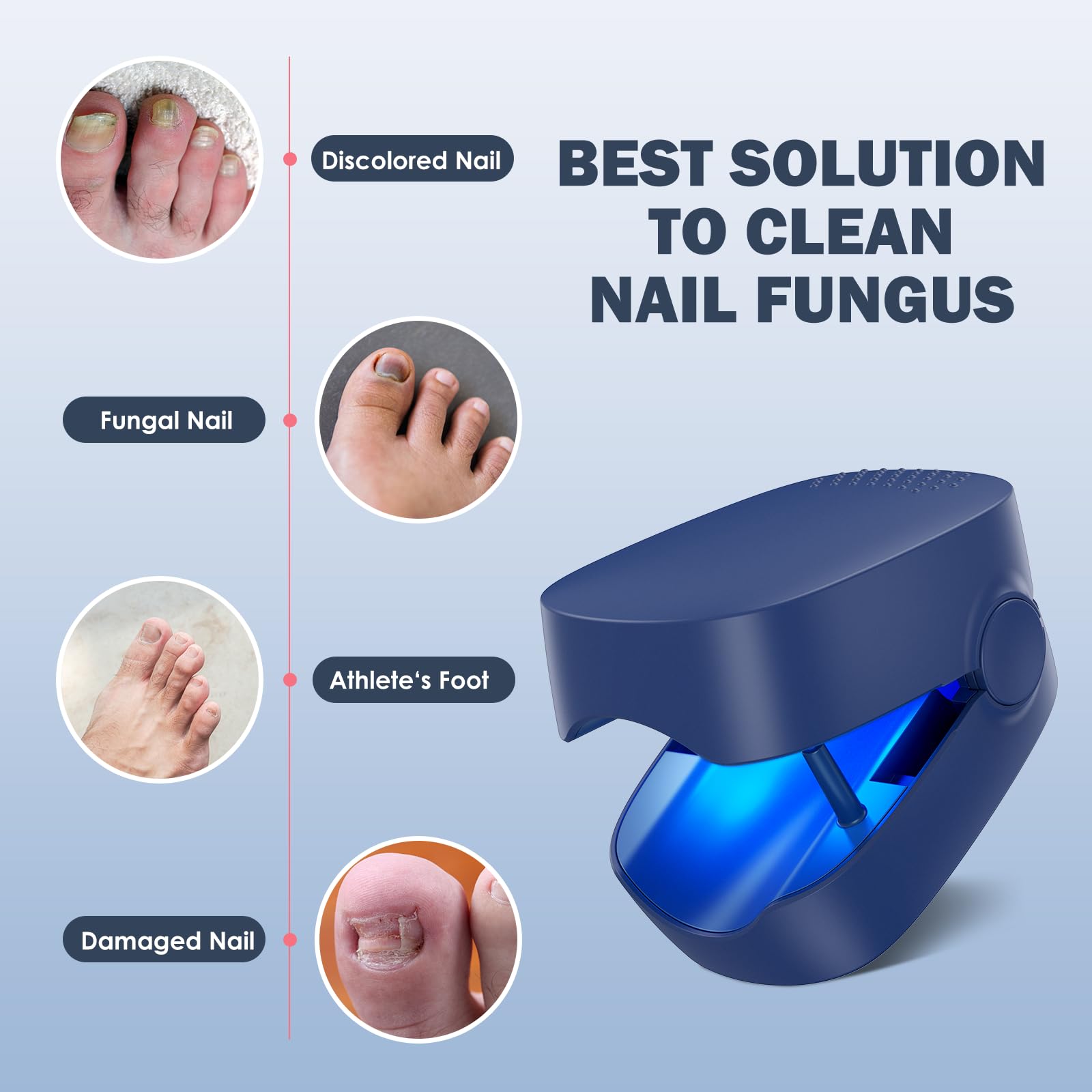 Best Nail Fungus Laser Treatment Device for Fingernails & Toenails | FSA/HSA Eligible Home Light Therapy | Effective Toenail Fungus Remover for Daily Use at Home or Travel