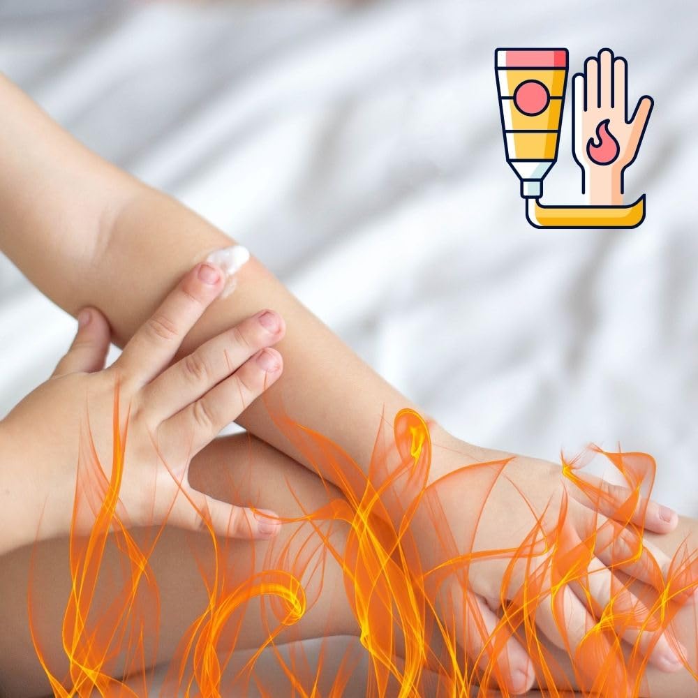 First Aid Burn Cream - Antiseptic Burn Relief in 0.9 gm Packets, 25 Pack (MS-60765) - Ideal for Minor Burns, Cuts, and Skin Irritations