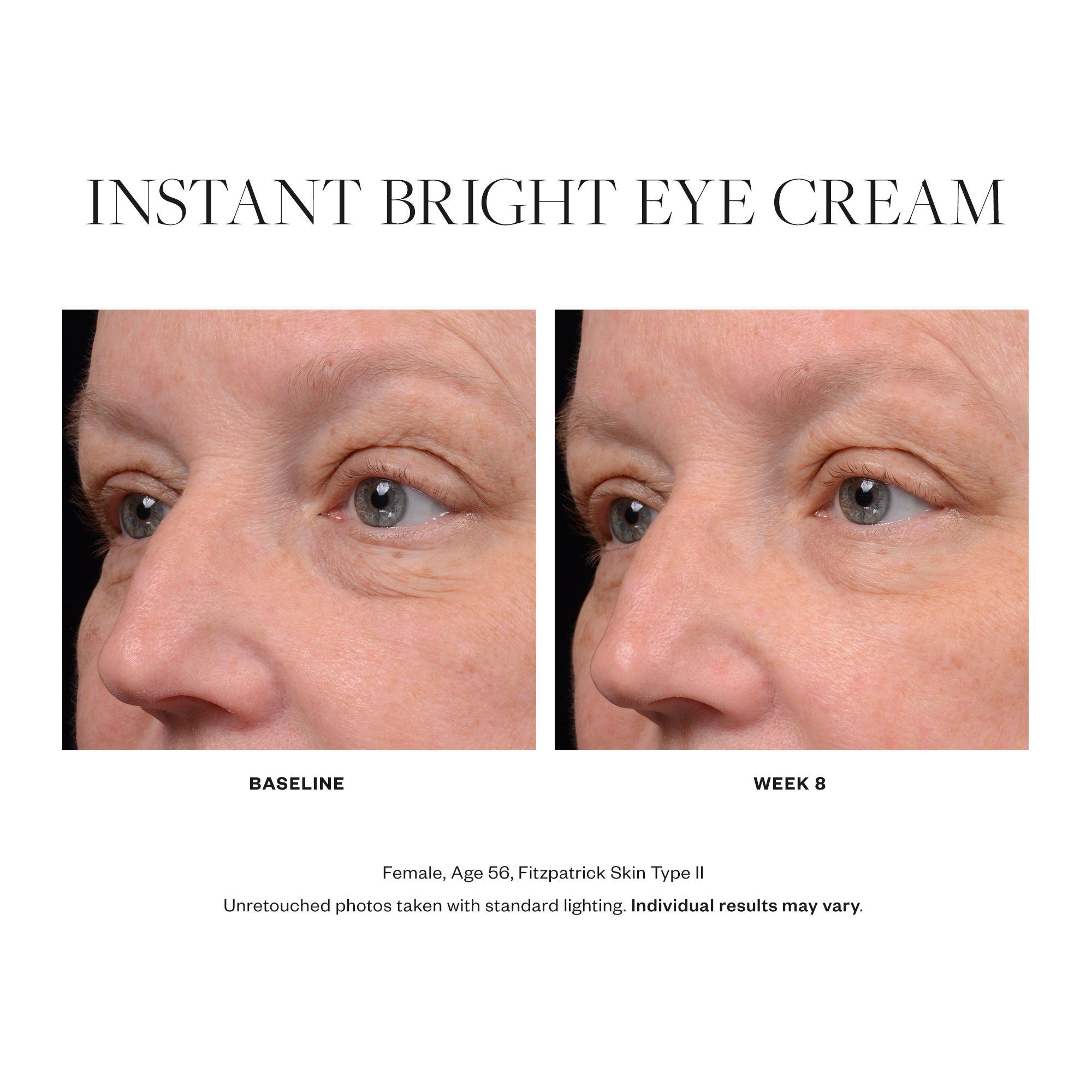 Instant Bright Eye Cream - Dark Circle & Puffiness Reduction for Men & Women - Hydrating Anti-Aging Treatment - Perfect for Morning Routine & Night Care