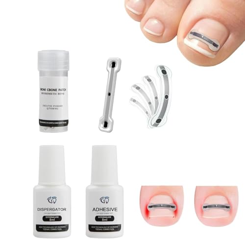 Professional Ingrown Toenail Removal Kit - Titanium Alloy Toenail Corrector Tool for Pain Relief & Home Treatment (0.75-0.82 Inch) - Perfect for Athletes, Runners & Daily Foot Care
