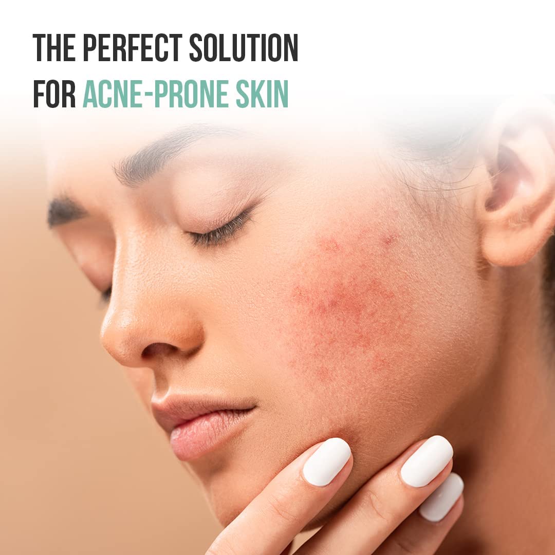 FURR Anti Acne Face Wash for Men & Women with 2% Salicylic Acid & Green Tea - 100ml | Reduces Redness & Controls Breakouts | Exfoliates Dead Skin Cells | Paraben-Free | Perfect for Daily Skincare Routine & Acne-Prone Skin