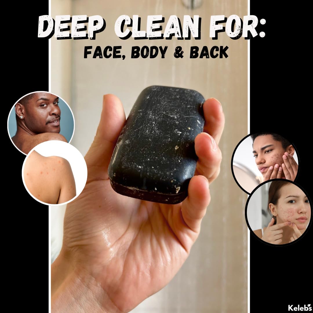 Activated Charcoal Soap Bar for Acne & Blackhead Prone Skin - Deep Cleansing Face, Body & Back Soap with Natural Ingredients - Plastic-Free, Vegan Friendly (3-Pack) - Perfect for Daily Skincare & Detox Routine