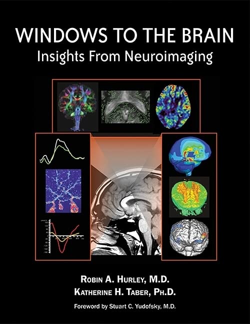 Windows to the Brain: Neuroimaging Insights for Neuroscience Research & Clinical Diagnosis | Brain Mapping Studies & Cognitive Function Analysis