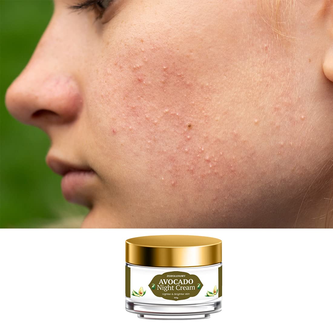 ZeroLuxury Avocado Night Cream - Deep Nourishing & Overnight Repair for Glowing Skin - 50g (Pack of 2) - Perfect for Summer Skin Prep & Nighttime Skincare Routine