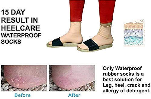 Zency Anti Crack Heel Protector Socks - Toe Free Heel Pain Relief for Men & Women - Comfortable Foot Care for Dry Cracked Heels - Perfect for Sleeping, Home Wear & Diabetic Foot Care