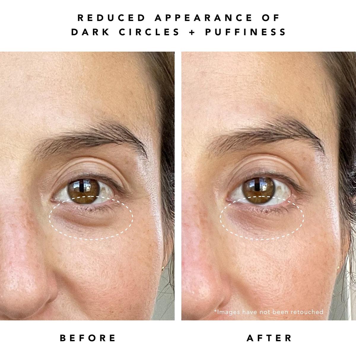 Super Nova 5% THD Vitamin C Brightening Eye Cream for Dark Circles & Puffiness - Anti-Aging Eye Treatment for Wrinkles & Fine Lines - Day & Night Use for Brighter, Youthful Eyes