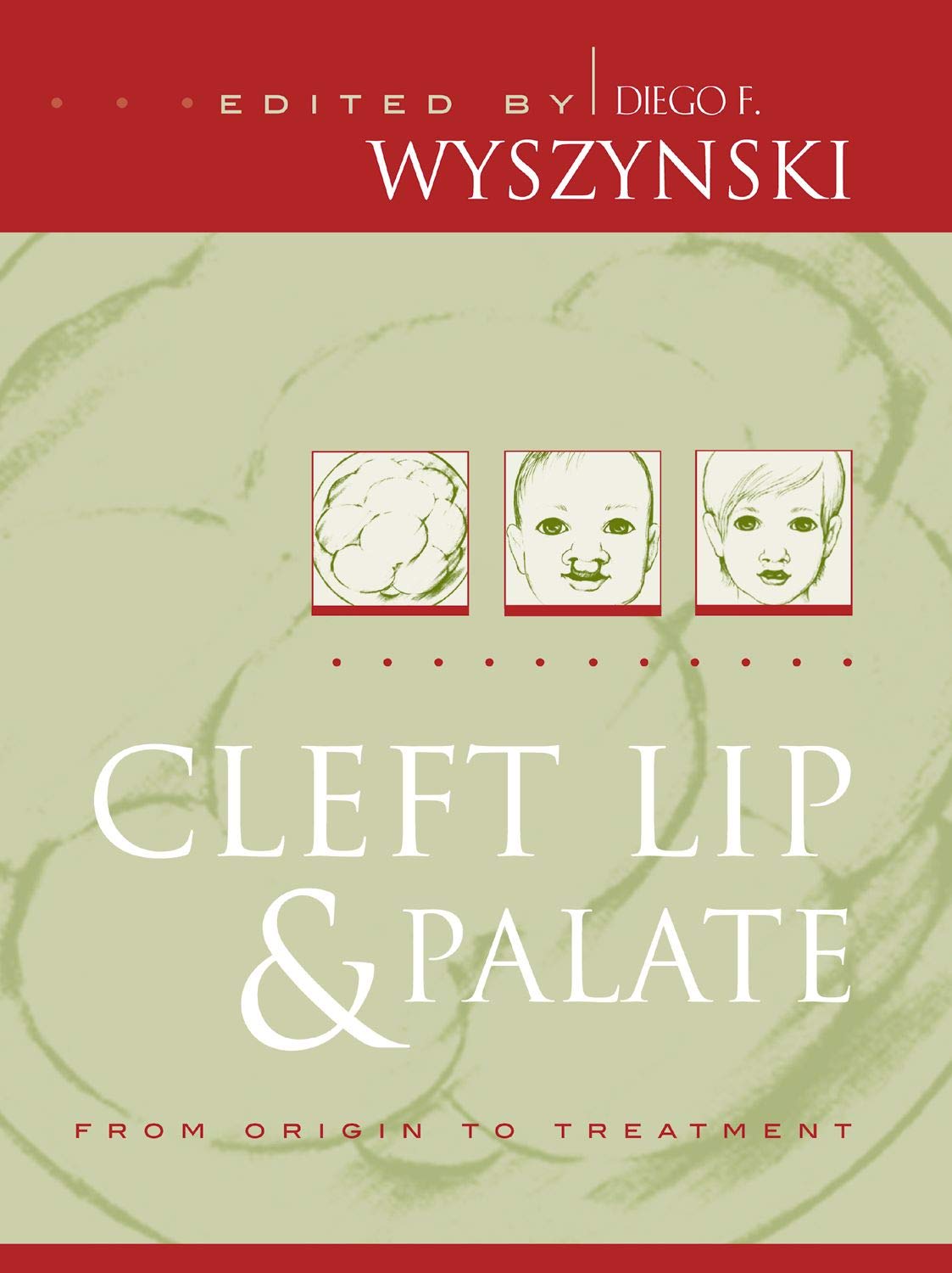 Cleft Lip and Palate Treatment Guide - Causes, Surgery & Recovery for Babies & Adults | Home Care & Feeding Tips