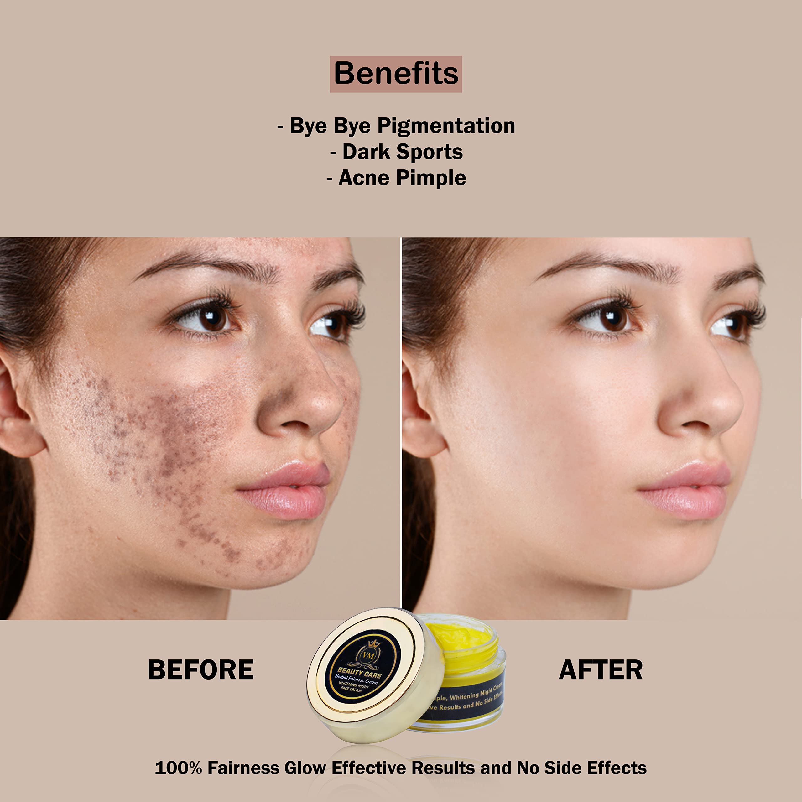 Mezco Acne Scar Removal Cream - Pimple & Dark Spot Treatment for Clear Skin | Daily Moisturizer for Women & Girls | Fights Acne & Pigmentation | Yellow (1 Pack) | Perfect for Daily Skincare Routine & Post-Acne Care
