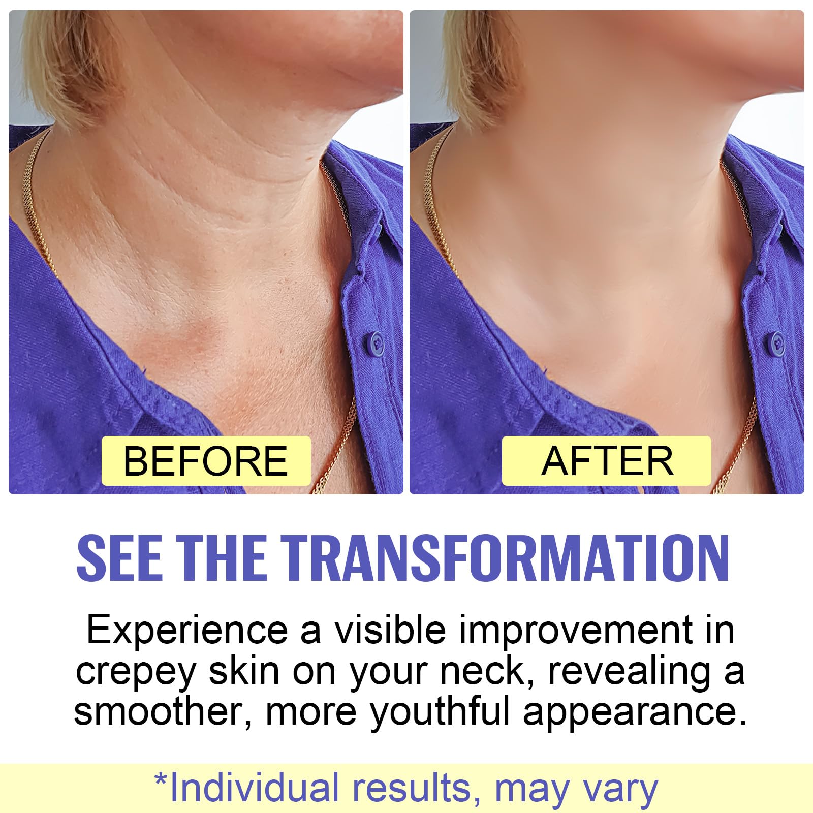 Anti-Aging Neck Firming Cream - Tightening & Lifting Treatment for Sagging Skin | Moisturizing Neck Cream for Crepey Skin & Wrinkles | Daily Skincare Routine for Youthful Neck & Décolleté