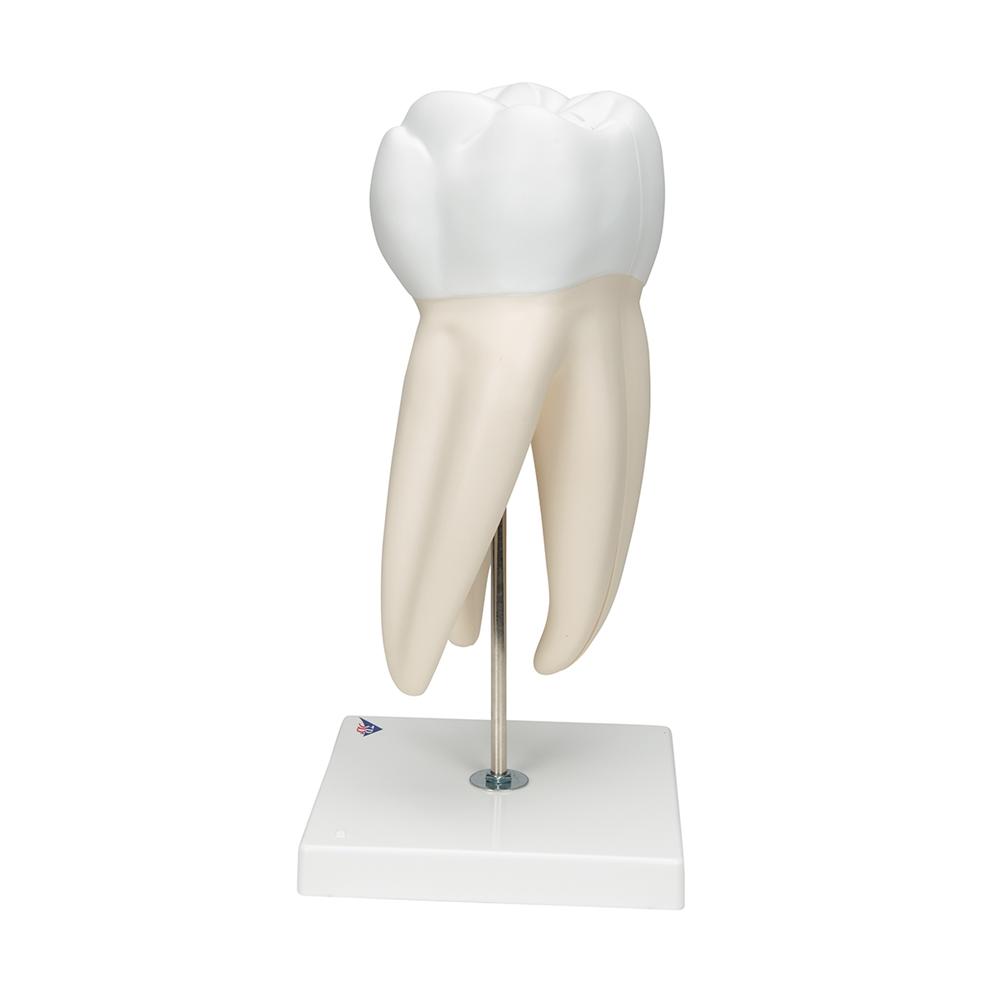 Giant Molar with Cavities - 15x Life Size Dental Model (5-Part) - Perfect for Dental Education, Classroom Demonstrations & Medical Training