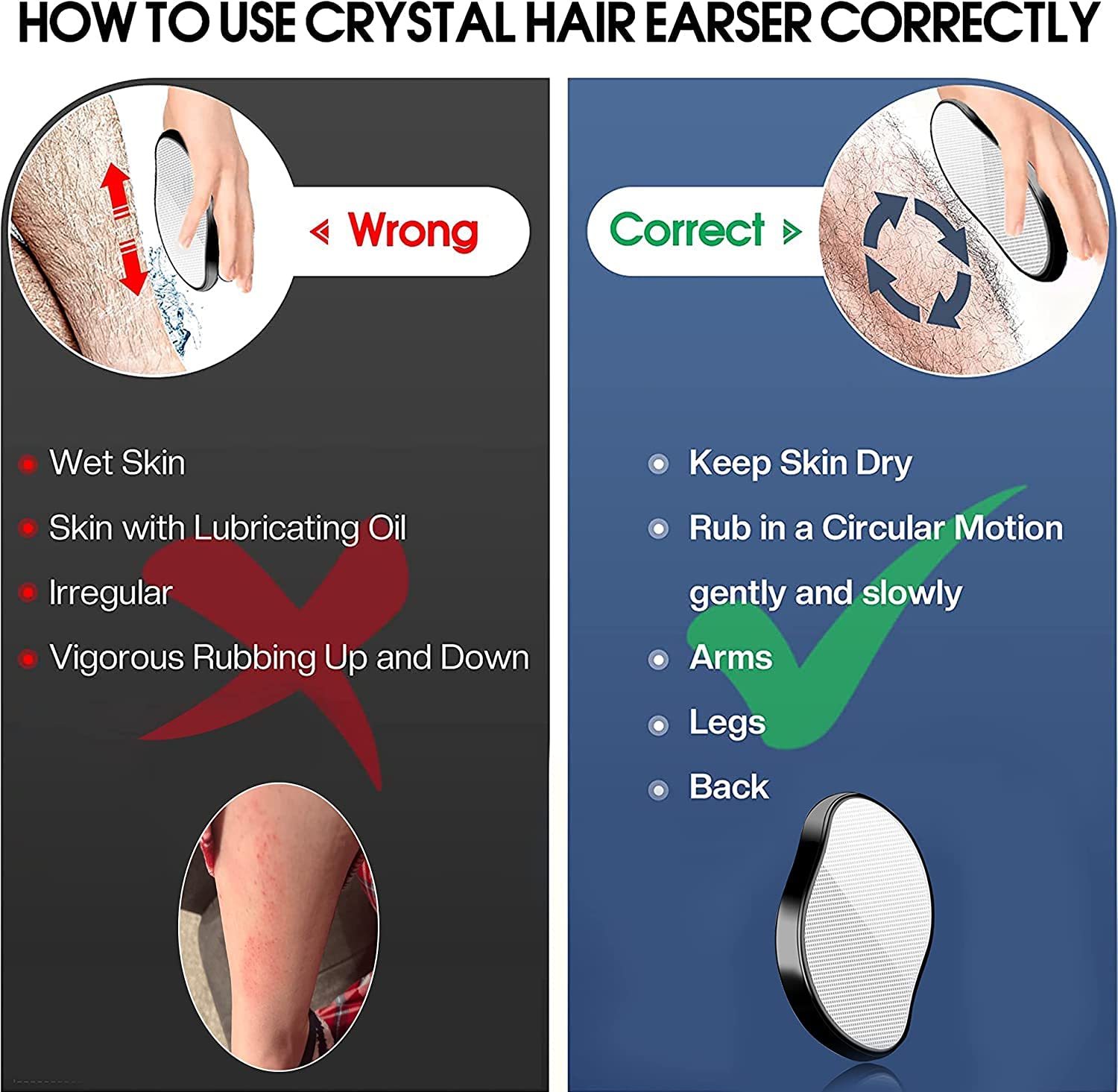 XSOURCE Crystal Hair Remover for Women & Men - Upgraded Nano-Crystalline Dots Technology, Painless & Reusable Hair Removal Stone - Perfect for Facial, Legs, Arms & Bikini Line Hair Removal at Home (Multicolor)