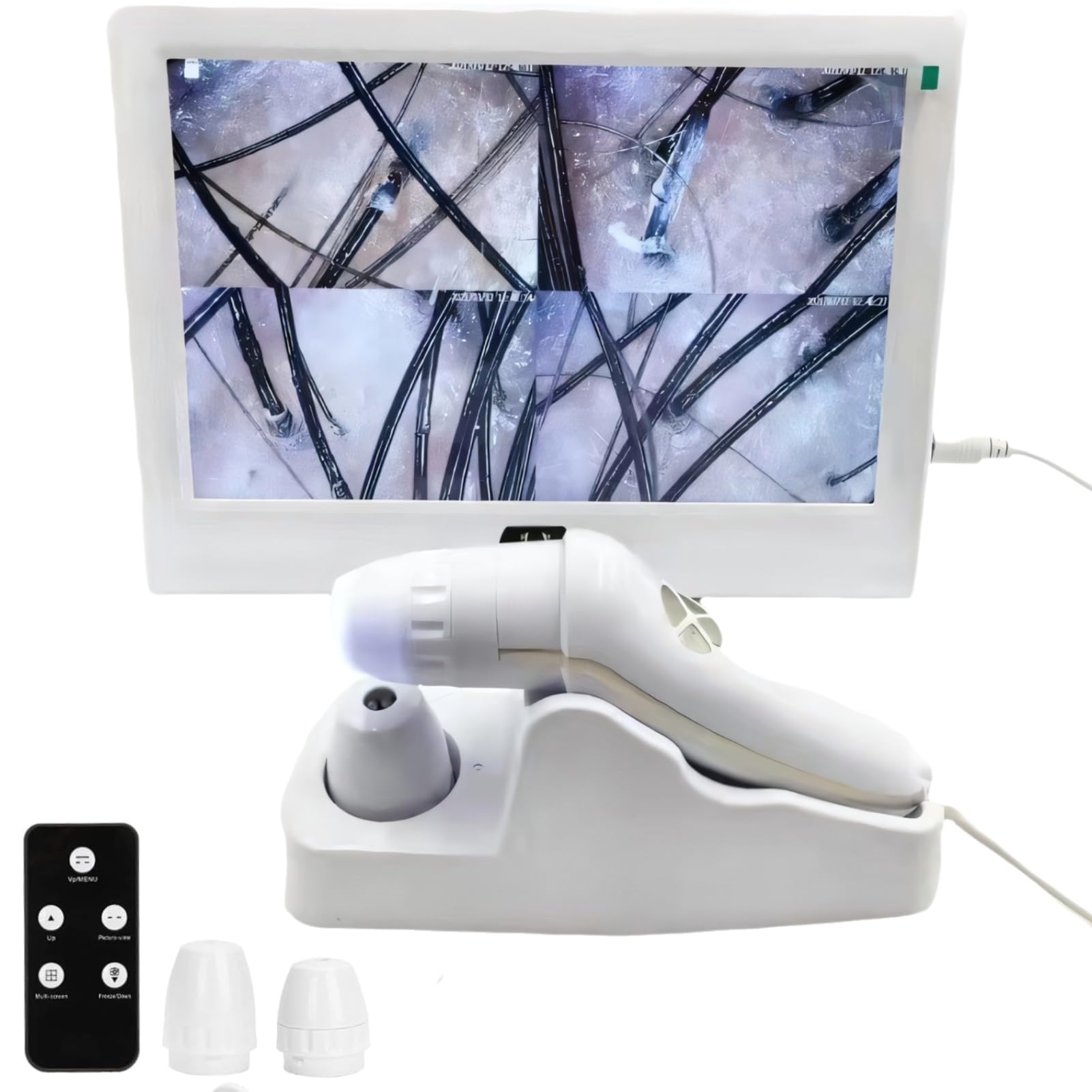 Professional 12-inch Skin & Scalp Analyzer - Multi-Functional Hair Follicle Detector with Rechargeable Battery (110-240V US Plug) | Perfect for Salon Treatments, Dermatology Clinics & At-Home Hair Care Analysis