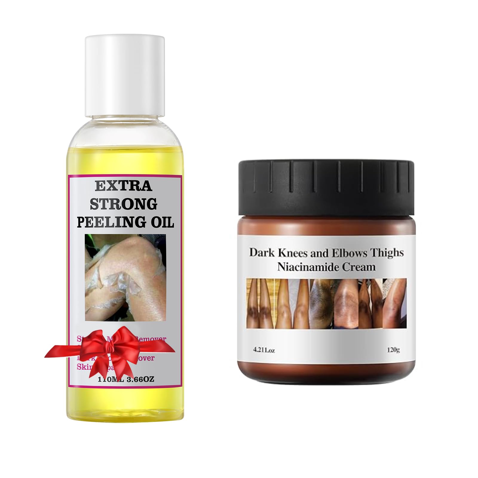 Strong Yellow Peeling Oil for Dark Skin - Extra Strength Chemical Exfoliant for Body, Hands & Feet - Dark Knuckle, Underarm & Toe Brightening Cream - Perfect for At-Home Spa Treatments & Skin Renewal