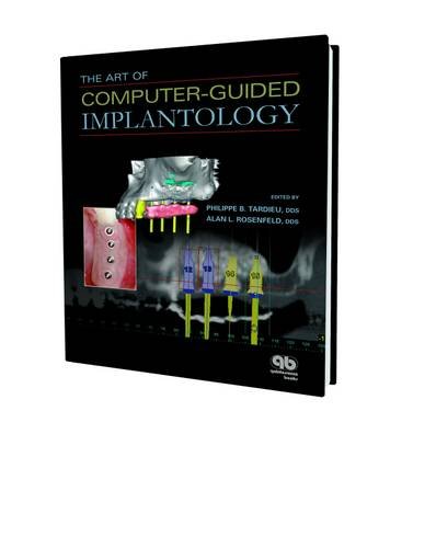Computer-Guided Dental Implantology Kit - Precision Surgical Guide for Dental Implants | Ideal for Dentists, Oral Surgeons & Dental Clinics