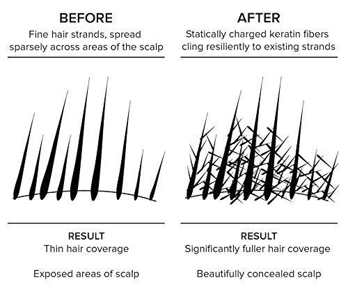 Stylazo Hair Fibers for Thinning Hair - Undetectable Natural Hair Thickener & Topper for Women - Instantly Conceals Hair Loss in 15 Seconds - 28g (Natural Black) - Perfect for Daily Use, Special Occasions & Confidence Boost