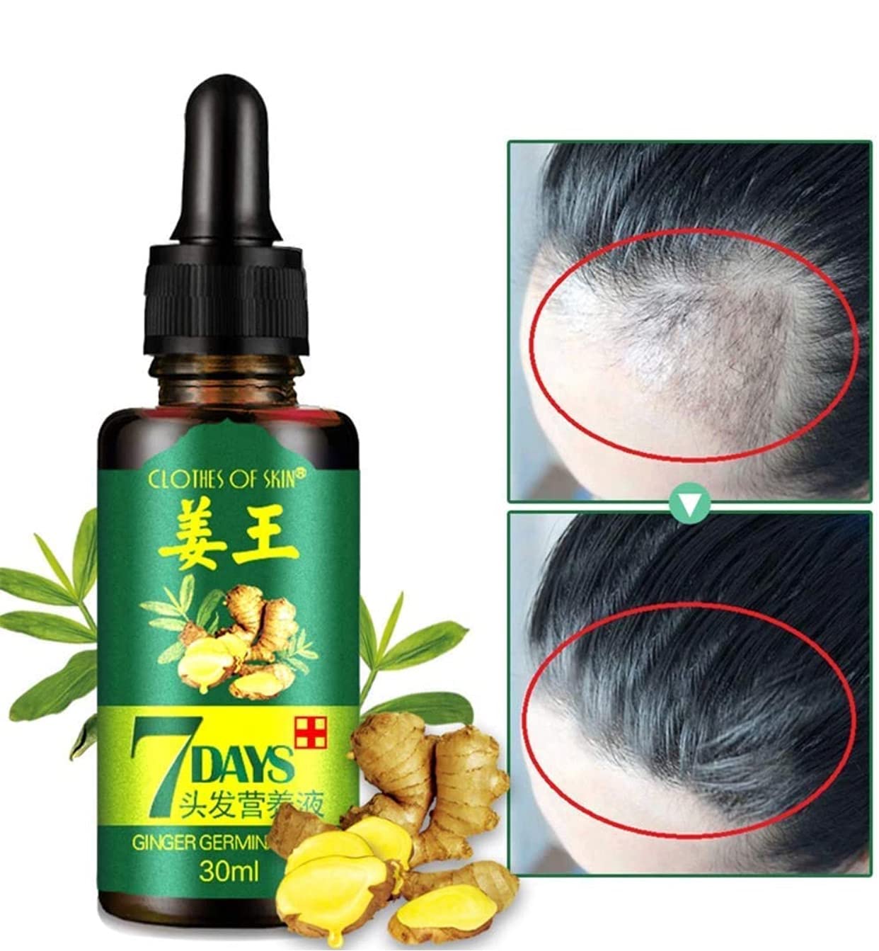 7 Day Hair Growth Treatment - Ginger Serum Essence for Thicker Hair & Scalp Care | Reduce Hair Loss & Stimulate Growth (1 Pack) | Perfect for Men & Women with Thinning Hair at Home or Salon Use