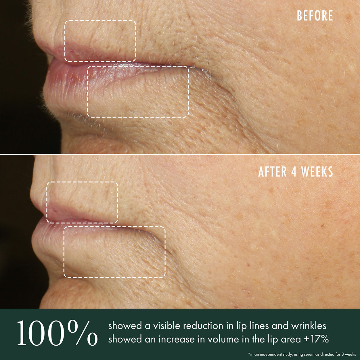 Advanced Lip Perioral Serum - Anti-Aging Vertical Line Filler for Smile Lines & Wrinkles | Perfect for Daily Skincare & Night Routine